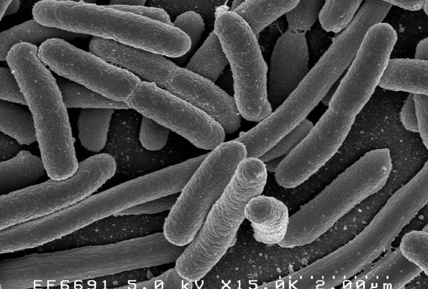 Electron microscope image of E. coli